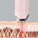 InFace-RF-Beauty-Instrument.jpg