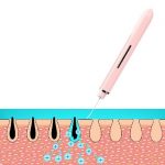 InFace-Ultrasonic-Ion-Cleanser.jpg
